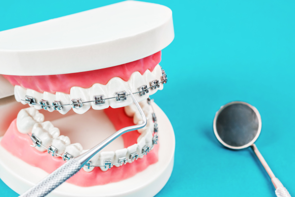 DentalPros Orthodontic Myths Debunked Separating Fact from Fiction