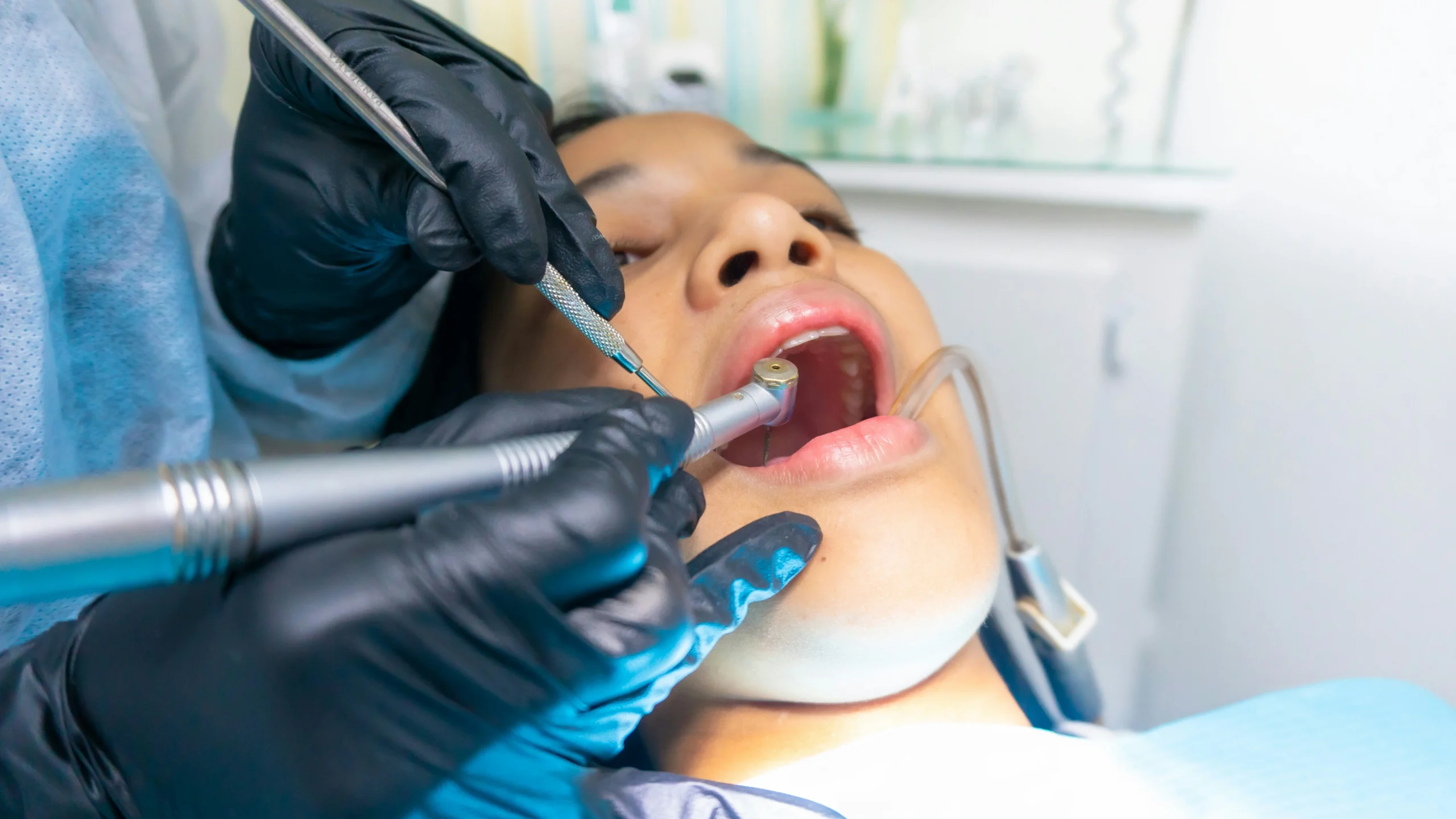 dental pros tucson bonding