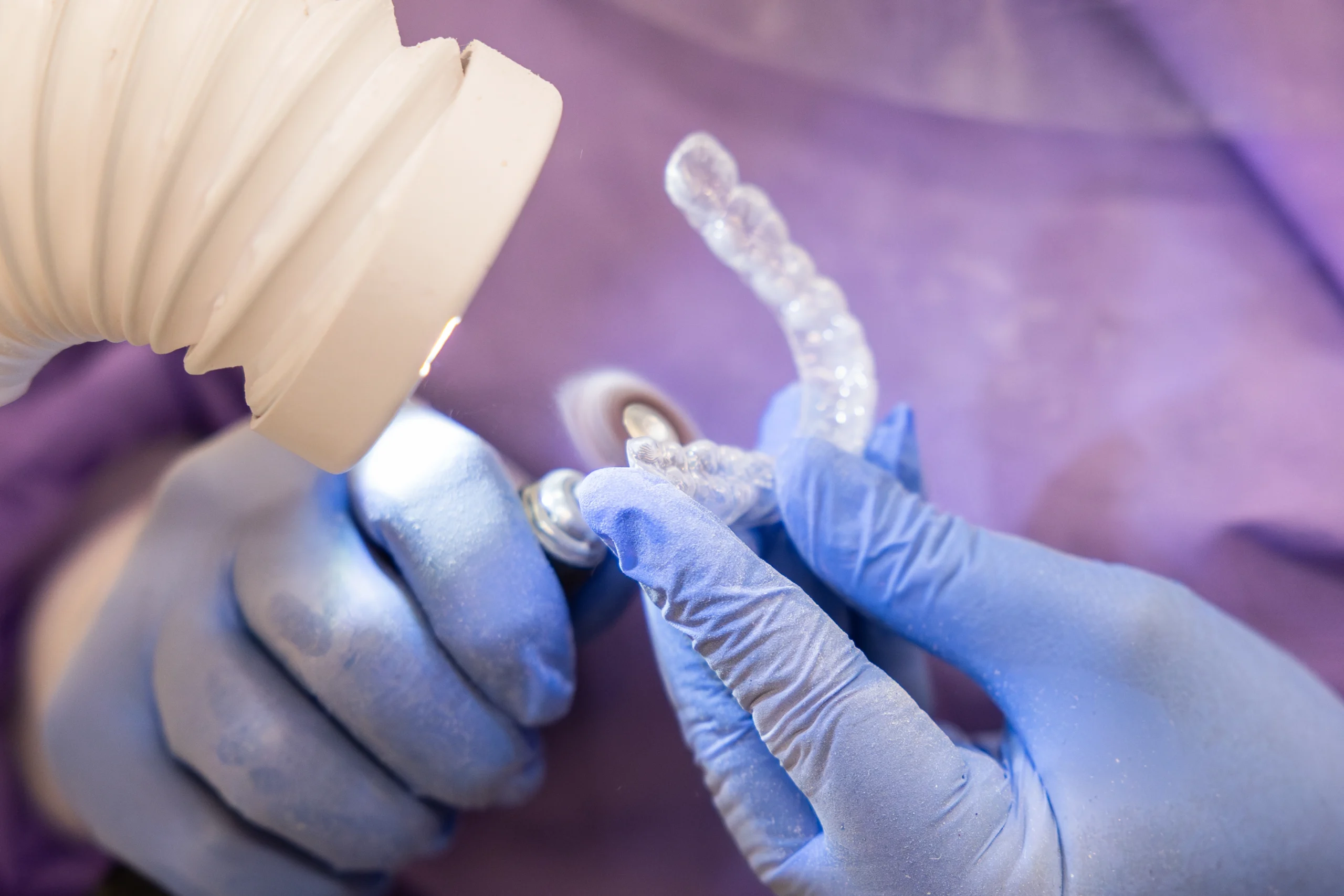 Clear aligners prepared for an Invisalign consultation